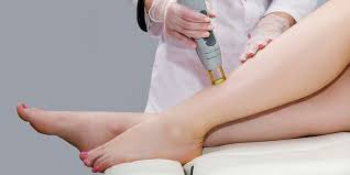Is Laser Hair Removal Acceptable in Islam?