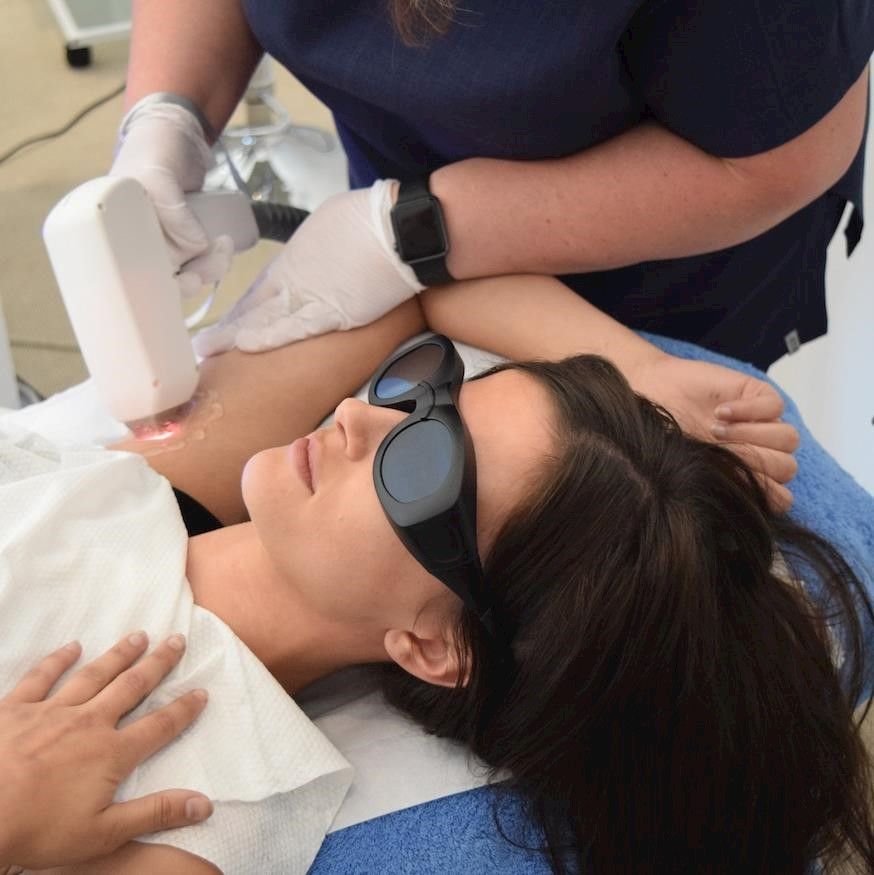 Is Laser Hair Removal Acceptable in Islam?