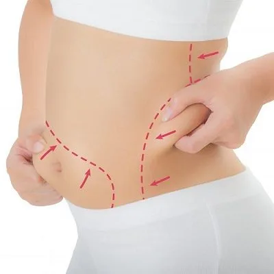 Liposuction Dubai Cost Deep Dive: All You Need to Know