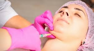 Double Chin Liposuction for Older Adults: What to Expect