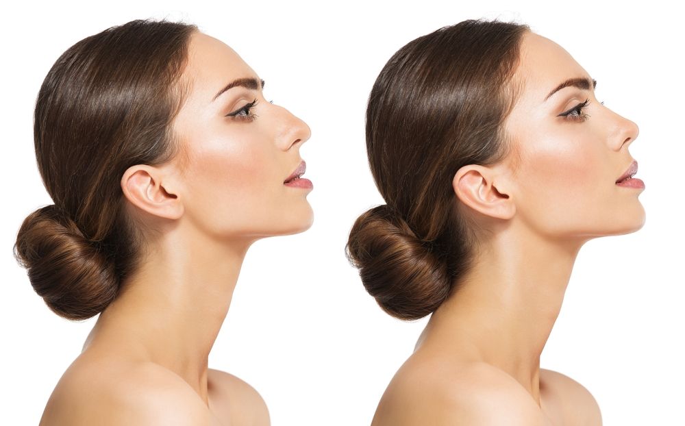 Glow Perfected Nose Sculpt For Balanced Facial Style Non-Surgical Rhinoplasty