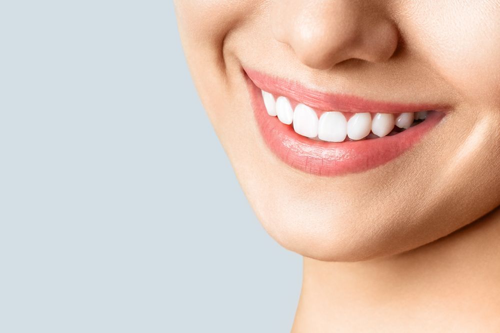Teeth Whitening Brings Radiant White Sparkle for Smile Upgrade